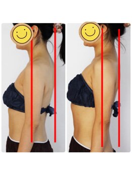 エルブラン(Herb ame)/姿勢を正すのが痩せ見えNO.1