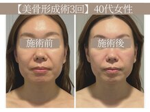 ドクターボディ 恵比寿店(Dr.Body)の雰囲気（【頬のたるみ/ほうれい線】施術はオーダーメイド  小顔/恵比寿）