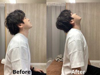 タダス 有楽町本院(TADASU)/初回 肩こり 30代