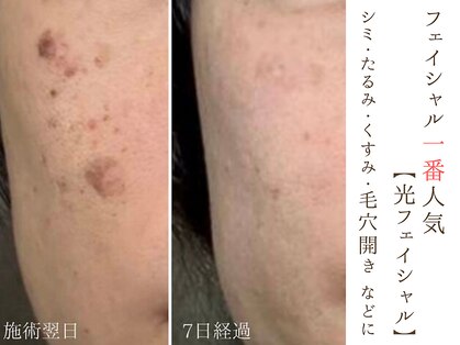 チャイディー(Chai Dee)の写真