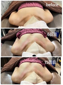 ロココ 豊田店(Rococo)/ビフォーアフター