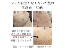 顔専門エステ 印西店の雰囲気（50代シミケア実績多数多数）