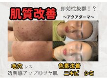 ココンフワット(Coconfouato)の雰囲気（様々な肌質悩みをお肌に合わせたアンプル導入で解決◎）