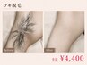 【男性限定】何回通っても同価格☆ワキ脱毛￥4,400