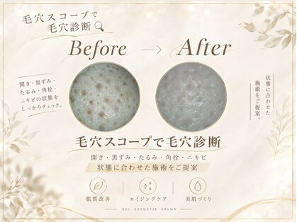 スイ(sui)の写真