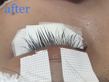 アイクイック 新宿 新宿駅西口店(Ai Quick)/ラッシュアディクト5ヶ月後