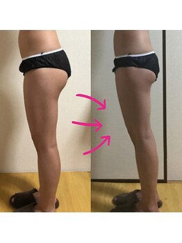 ピアリーノ(Pialino)/