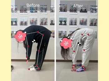 ナオル整体 大宮院(NAORU整体)/腰をそった時の痛みが軽減！