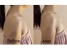 【肩こり・巻き肩・猫背】姿勢改善する背中コルギxデコルテ70分￥9500→ 
