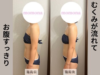 モモナ(Momona)/#肩こり#リンパマッサージ#野並