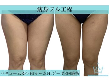 リメイク 広尾(REMAKE)/