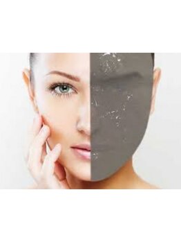 美白ケアをしたい