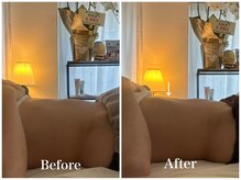 リリー 中目黒(Lily)/60分施術 Before→After