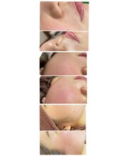 ラマジ(Lamazi)/フェイシャルワックス