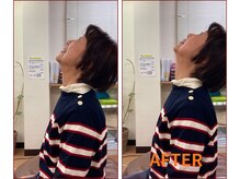船橋カイロプラクティックオフィス/首痛、ストレートネックの悩み