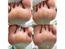 巻き爪補正店 小倉店の雰囲気（タコ・魚の目のお悩みもご相談ください！）