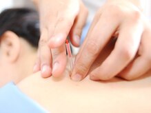 ナツメ鍼灸院(natume鍼灸院)