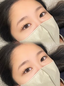 ルナビューティー(Luna beauty)/