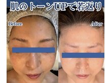 リアンシャンテ(Re enchanter)の雰囲気（17種ハーブ×スピキュールで美肌菌の再生と強化。透明感素肌へ！）