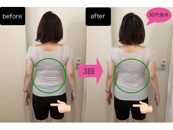 イーリス(i-ris)/美容整体×骨盤調整×リンパ