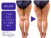 ビューティスト(Beautist)/【Before＆After】下半身集中