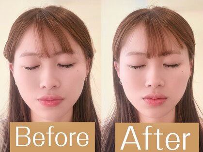 アカシア鍼灸整骨院の写真
