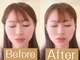 アカシア鍼灸整骨院の写真