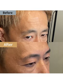 眉毛ハウス 吉祥寺店(眉毛HOUSE)/お客様の施術例(吉祥寺/東京)