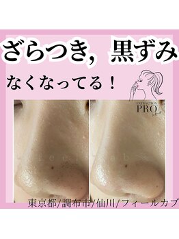 フィールカブ 仙川(feel kab)/毛穴ケアは当店にお任せください