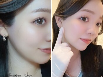 エヴァワックス 恵比寿店(Eva Wax)/【女性人気】うなじもみあげ脱毛