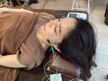 ハリファ鍼灸院 横浜関内院(HariFa鍼灸院)/美容施術