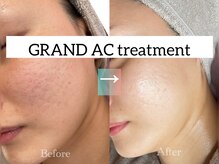 サザンベル 石垣店(SOUTHERN BELLE)/グランACトリートメント