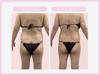 アコガレコガオ 盛岡店/