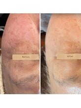 ラマラマ(Rama Rama)/ハリツヤ・トーンUP！