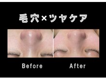 エステティック レイビス 銀座店(RAYVIS)/