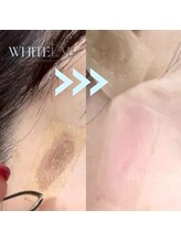 リシェル(Richelle)/【WHITELAB☆はがれるシミケア】