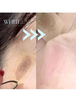 リシェル(Richelle)/【WHITELAB☆はがれるシミケア】