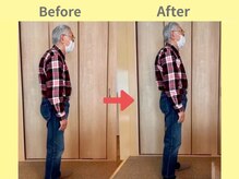 アイノテ メディカルボディケア(Ainote medical body care)/［80代男性/首・肩こり/腰痛］