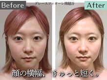 グレースフィオーレ 南越谷店(gracefiore)
