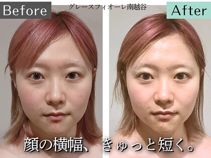 グレースフィオーレ 南越谷店(gracefiore)の写真