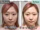 グレースフィオーレ 南越谷店(gracefiore)の写真