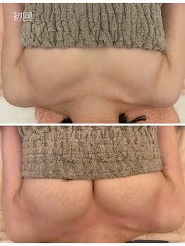 美人バスト 岡崎店/【バストアップ★育乳】症例
