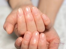 ツリートップ(Tree Top)/深爪矯正～ネイルケア
