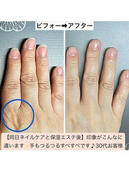 桃の木 吉祥寺店/手のエステで潤いふっくら