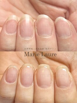 マリーロール 淀屋橋本店(Marie Laure)/自爪育成/深爪矯正/ネイルケア