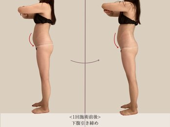 エル 麻布十番(LllL)/【痩身】下腹引き締め