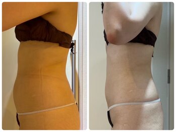 エイシスグロウ(asis glow.)/効果写真