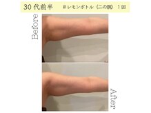 メルローズ 自由が丘店(Melrose)/【お客様の効果写真】