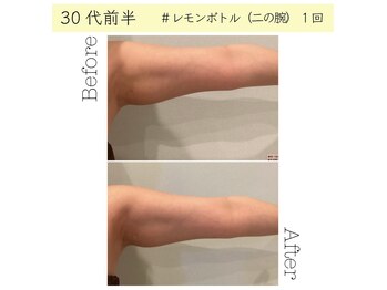 メルローズ 自由が丘店(Melrose)/【お客様の効果写真】