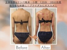 シェルシア(Cielcia)/全身筋膜＆リンパ痩身+小顔120分